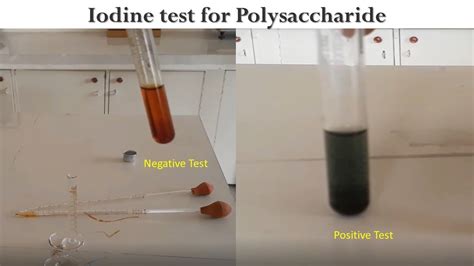 Iodine Test Youtube