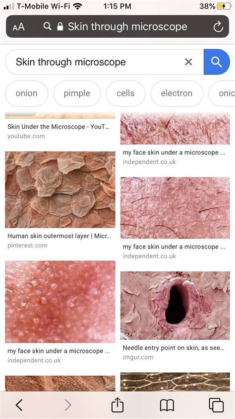 Thanks, I hate skin under a microscope : r/TIHI