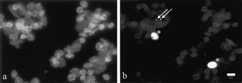 Combined Analysis Of Dna Ploidy Proliferation And Apoptosis In