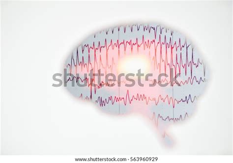 Brain Wave On Electroencephalogram Eeg Epilepsy Stock Photo (Edit Now ...