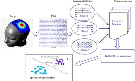 A Computer Aided Analysis Scheme For Detecting Epileptic Seizure From