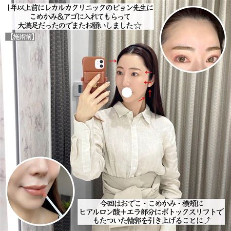 まぃまぃさんのインスタグラム写真 まぃまぃinstagram「2023夏／ Myスキンケアまとめ📝 先日ストーリーで ヒアルロン