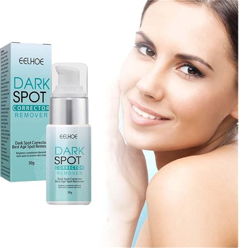 2023 New Dark Spot Remover Cream For Face Musely Dark Spot