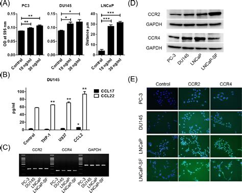 Figure 2 From Tumor Associated Macrophages Promote Prostate Cancer