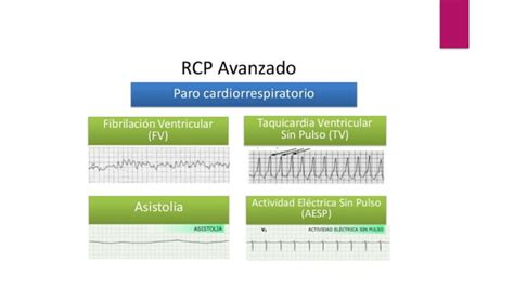 ACLS R1 Urgencias Medico Quirurgicas Abordaje PPT