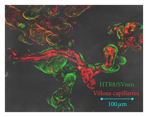 Htr Svneo Spheroid Cells Repopulate Chorionic Villi Of Placental