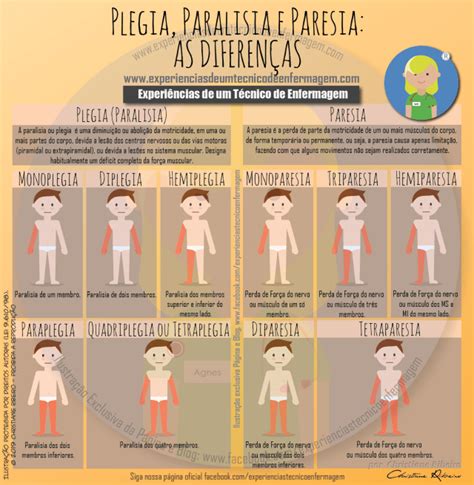 Parestesia E Paresia - Plegia, Paralisia e Paresia: As Diferenças - Enfermagem Ilustrada
