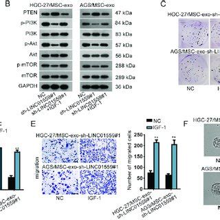 Linc Accelerated Gc Progression By Activating Pi K Akt Pathway A