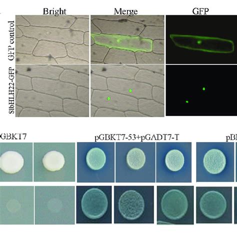 Subcellular Localization And Transcription Activity Of SlbHLH22 A