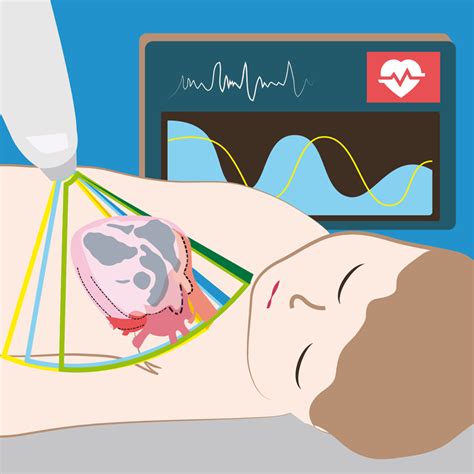 Pediatría Basada en Pruebas Nuevo curso en Continuum Ecocardiografía