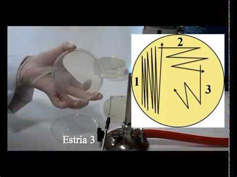 Técnicas básicas de Microbiología Aislamiento y siembra en estría de