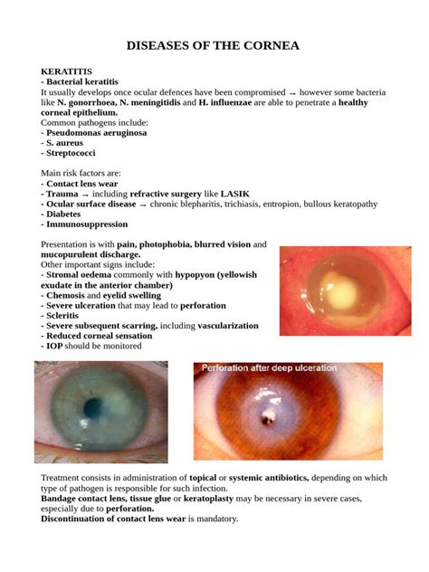 Diseases of The Cornea | PDF | Cornea | Vision