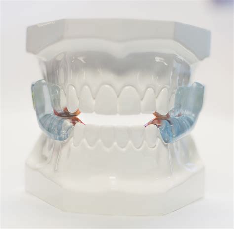 Life With An Oral Appliance New Jersey Sleep Apnea Solutions