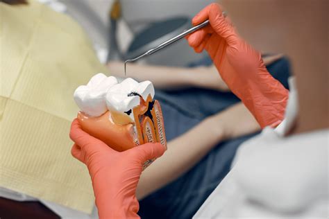 What Is The Process For Tooth Fillings Easton Dental