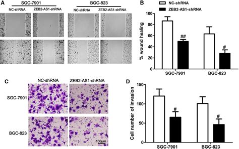 Knockdown Of Zeb2 As1 Suppresses The Abilities Of Cell Migration And