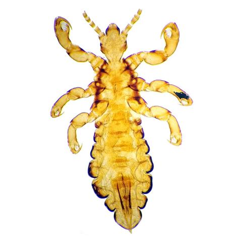 human head louse wm prepared microscope