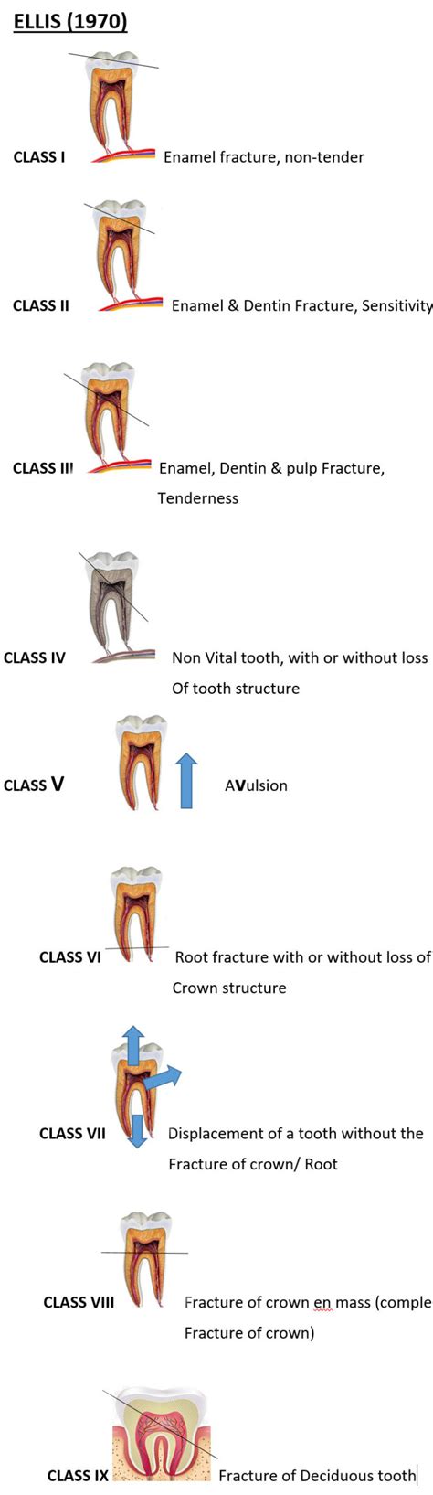 Tooth Fracture Classification