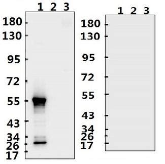 Anti SARS CoV 2 Nucleoprotein Antibody Rabbit Polyclonal ELISA WB LSBio