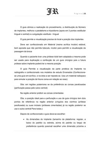 AV2 Resumo de implantodontia Autoria João Ricardo PDF