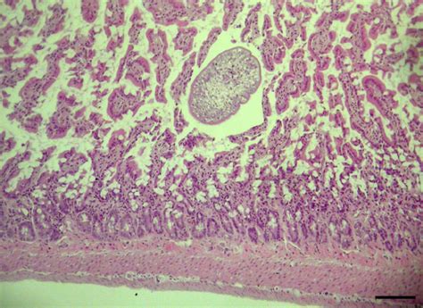 Histopathological Slide Of The Small Intestine Haematoxylin And Eosin