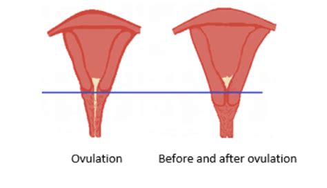 Change In The Location Of Cervix During A Normal Menstrual Cycle