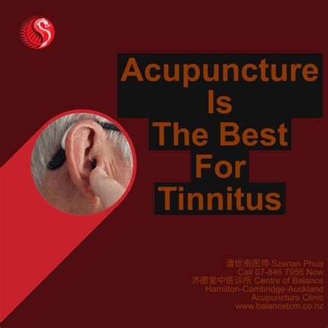 Acupuncture Is The Best For Tinnitus Treatment Best Acupuncture Hamilton Nz