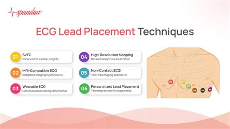 Optimal ECG Lead Placement: Key Tips for Accurate Readings