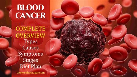 Blood Cancer - Complete Overview