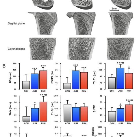 Micro CT Analysis Of The Trabecular Bone Architecture Of The Distal