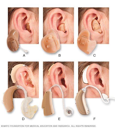 Hearing Loss Disease Reference Guide Drugs