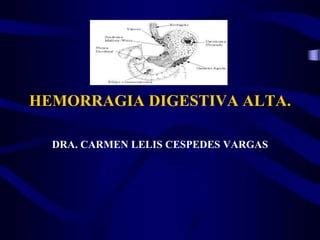 Hemorragia Digestiva Alta Ppt