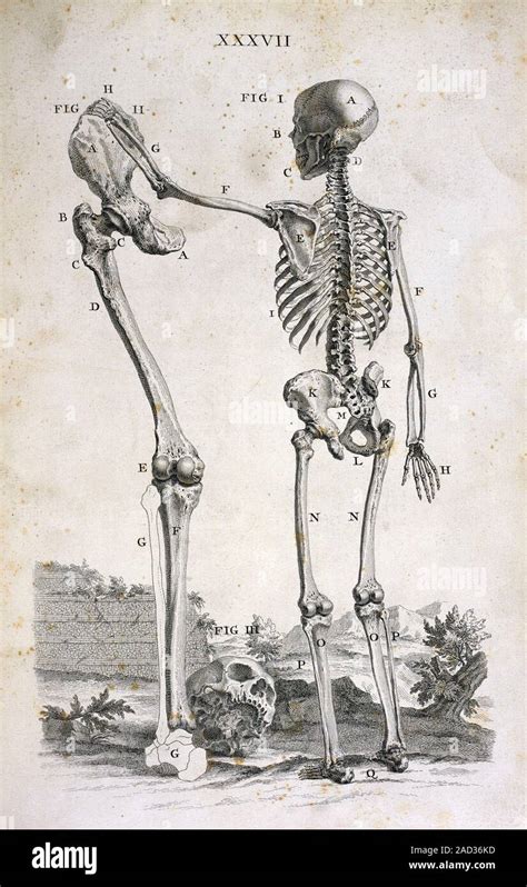 Skeleton and giant's leg, 18th-century illustration. Gigantism (excessive growth) is usually ...