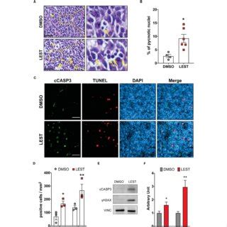 Lestaurtinib Induces Apoptosis And DNA Damage Accumulation In Vivo A