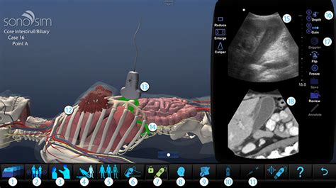 Sonosimulator Features Ultrasound Simulator Sonosim