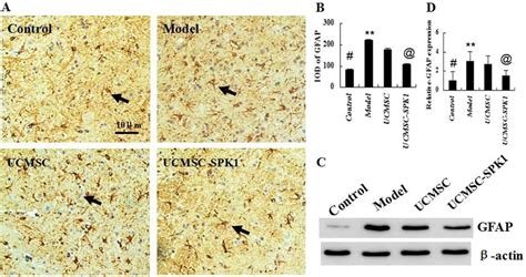 The Expression Of GFAP In The Spinal Cords A B Contrasting To The