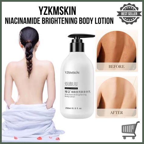 No Trending Yzkmskin Niacinamide Brightening Lotion Ml Lazada Ph