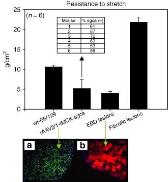 Resistance To Passive Stretch Force Mechanics On Extensor Digitorum