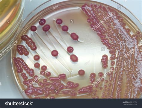 Klebsiella Pneumoniae Nutrient Agar