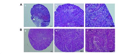 Hande Staining Of Fetal Testis On D4 In The Modified Group Hande Staining