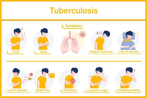 Vector Illustrations Infographic Of Tuberculosis Symptoms Fever Chills