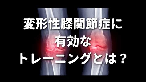 変形性膝関節症に有効なトレーニングとは？ リハビリ訪問看護ステーション蕾