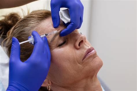 Understanding The Basics Of Botox A Comprehensive Guide For Beginners