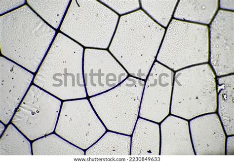 Dragonfly Wing Under Microscope Looking Microscopic Stock Photo ...