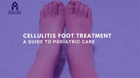 Cellulitis Foot Treatment A Guide To Podiatric Care