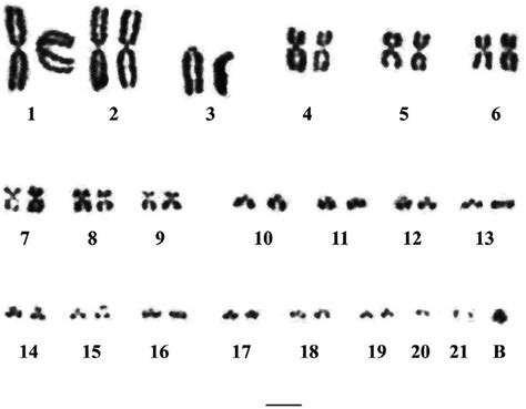 Somatic Male BUB1202 Metaphase Karyotype With The Karyotypic Formula