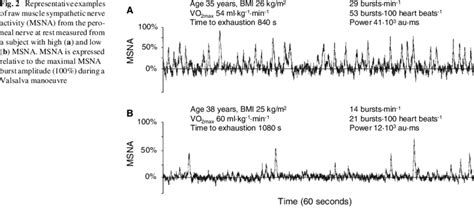 Representative Examples Of Raw Muscle Sympathetic Nerve Activity Msna