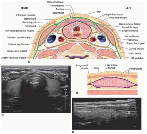 The Thyroid Gland Parathyroid Glands And Neck Radiology Key