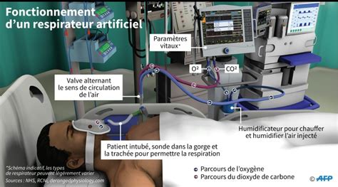 Respirateurs Face Une Forte Demande L Industrie S Organise