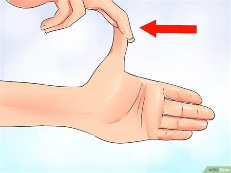 When To Have Carpal Tunnel Surgery Mapasgmaes