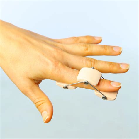 Boutonniere Finger Splint